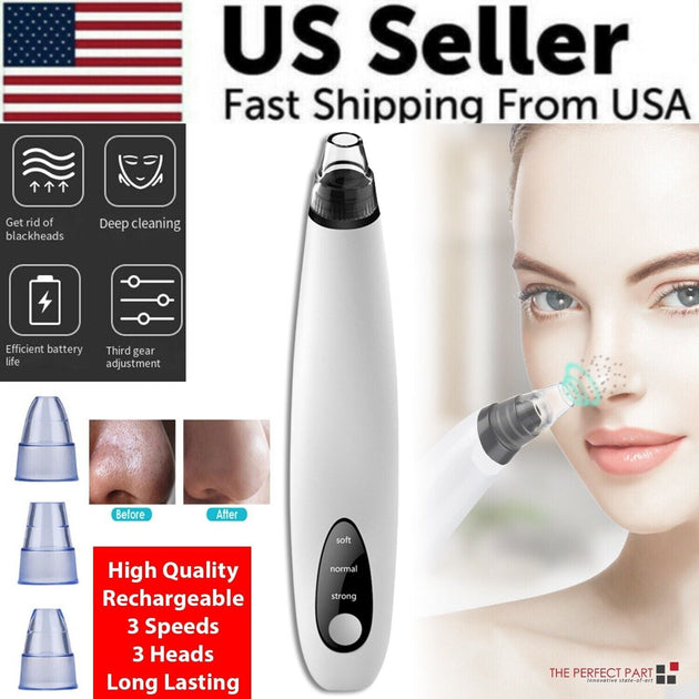 Proxxi Electric Blackhead Remover Black 3